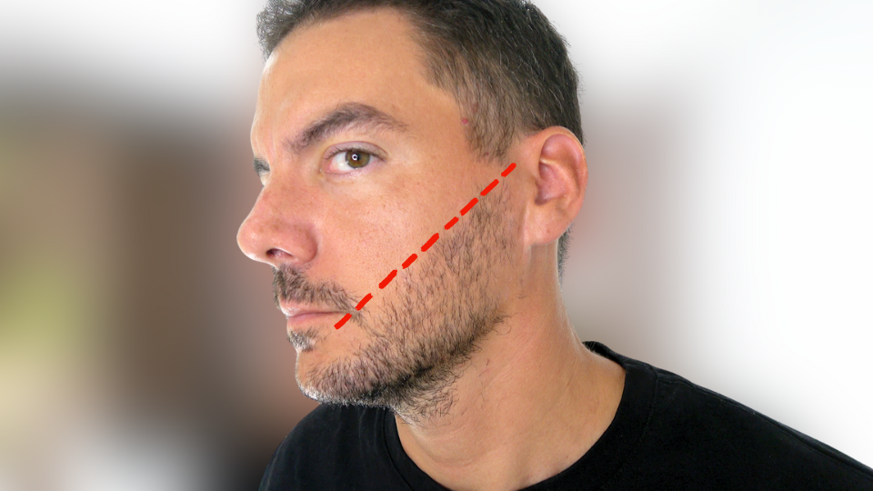 stubble beard cheek line